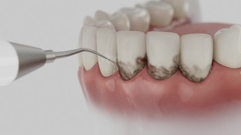 Trusted Dental Implants service in Natchez, MS - Dentist Open Now